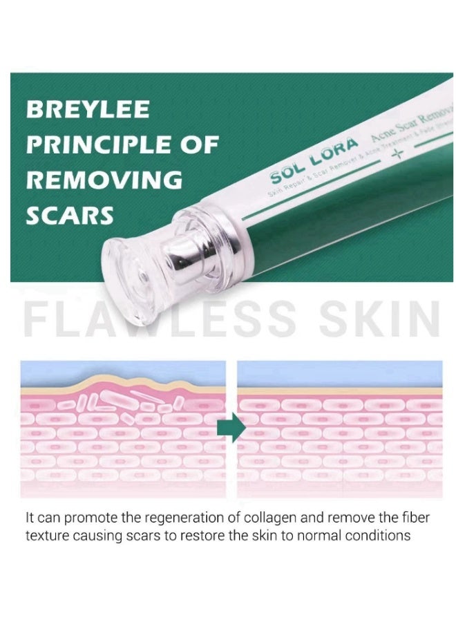 SOL LORA Multi-Effect Scar Removal Cream, Acne Treatment, Scar Fading, and Blemish Smoothing 30g - Image 3